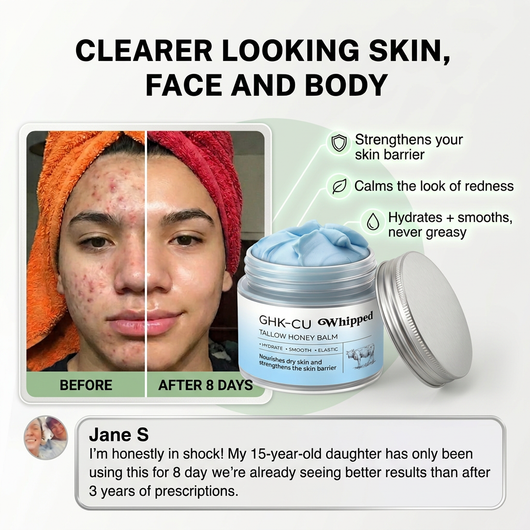Solvée Anti-Acne GHK-CU Cream