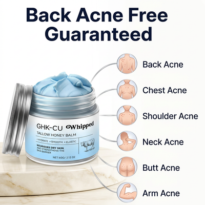 Solvée Anti-Acne GHK-CU Cream