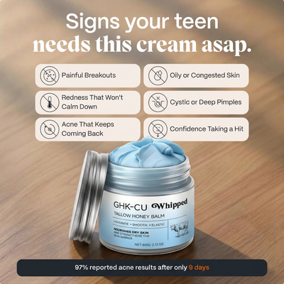 Solvée Anti-Acne GHK-CU Cream